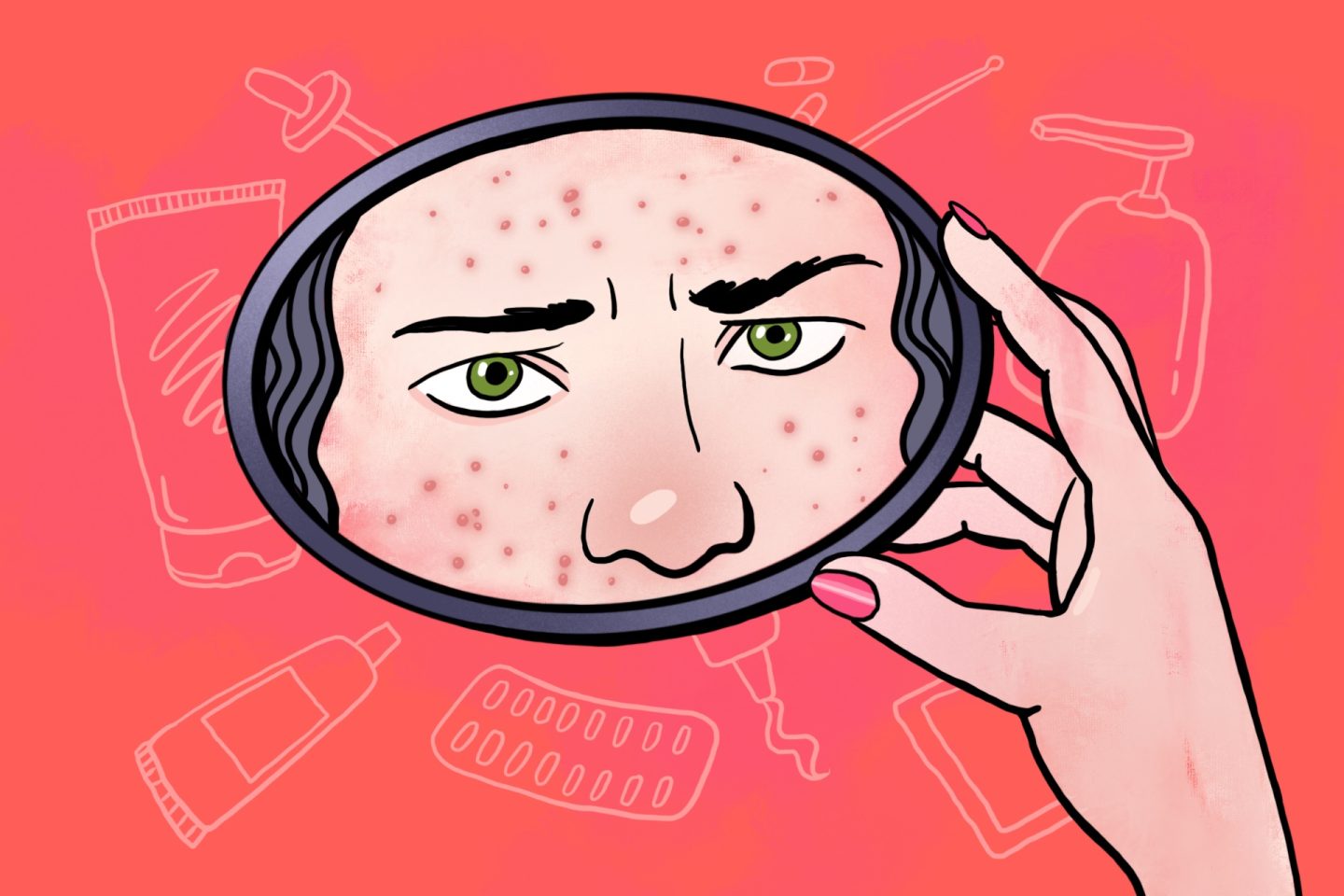 «На мне стоит клеймо проблемной кожи»: история девушки, которая много лет «боролась» с акне