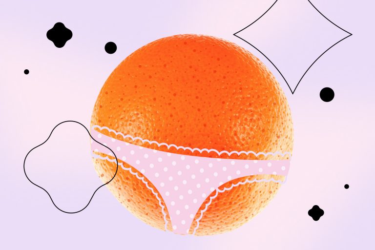 Что такое целлюлит и нужно ли его лечить - Горящая изба