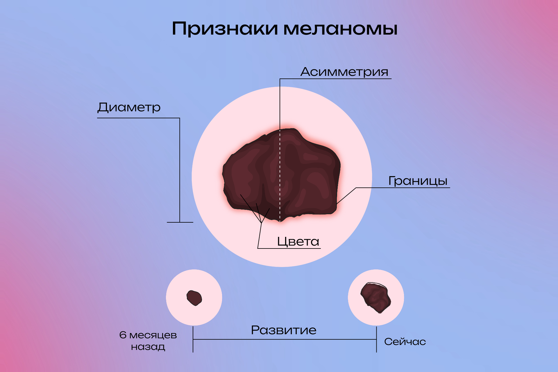 Какие бывают пигментные пятна и как с ними бороться - Горящая изба