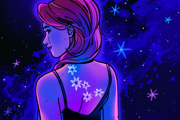 Почему появляются родинки и что с ними делать - Горящая изба