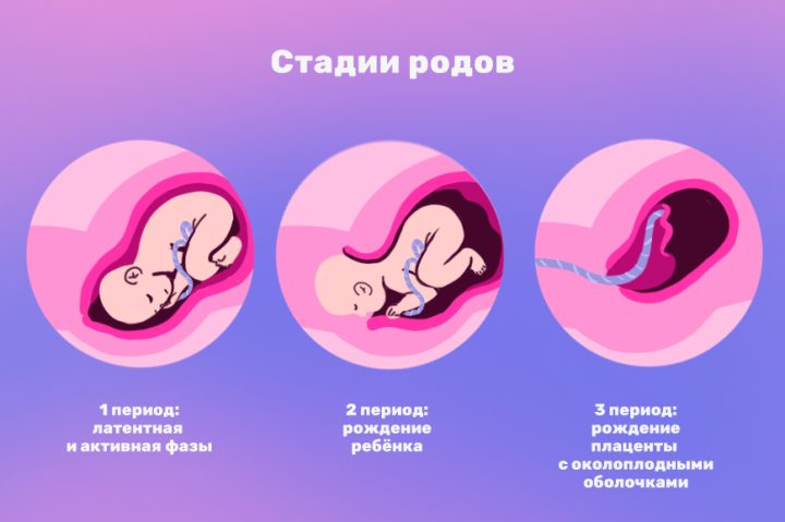 Как понять, что начались роды: стадии родов